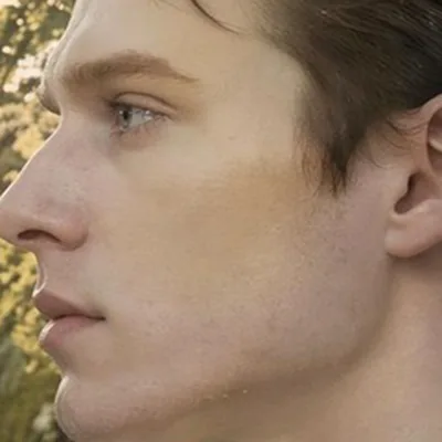 The Patient — The broken boy who is part machine